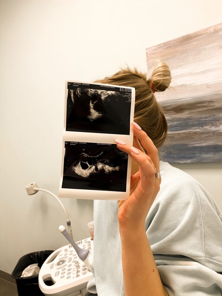 IVF Journey Update